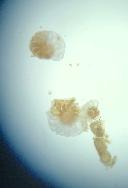 snailmagnify-2.jpg